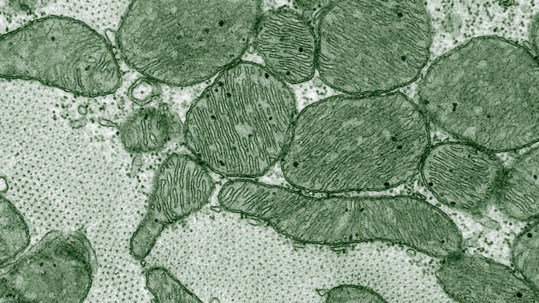 Transmission electron microscopy image of mitochondria in heart muscle. © EPFL / CIME
