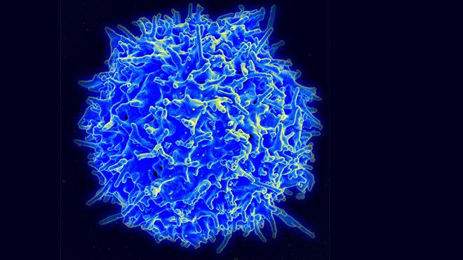 Human T-Cell - Creative commons NIAID/NIH