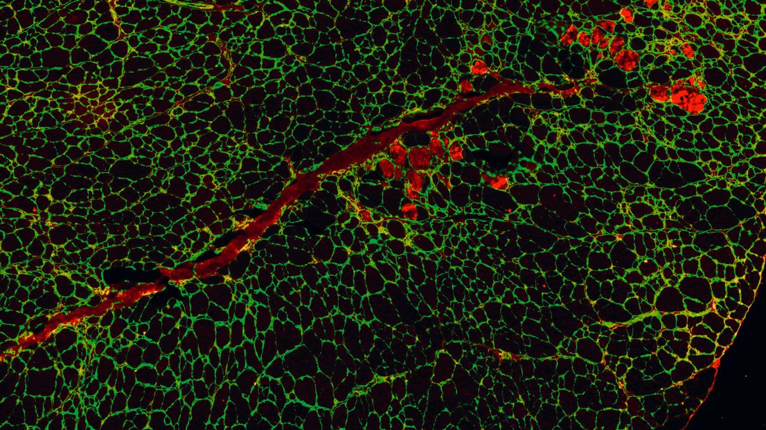 Regenerating muscle cells thanks to Urolithin A. © Amazentis / EPFL Auwerx Lab Regenerating muscle cells thanks to Urolithin A. © Amazentis / EPFL Auwerx Lab