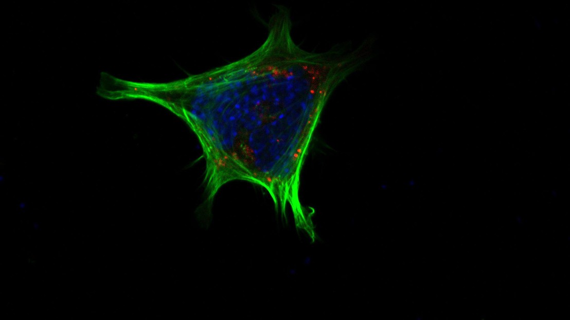 © 2021 EPFL / Schoonjans' lab