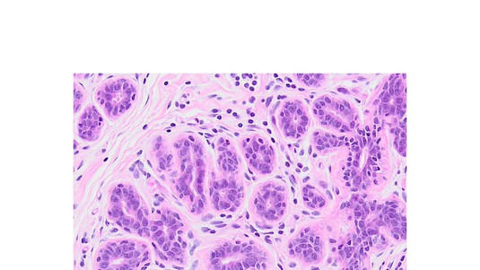 Hematoxylin and eosin-stained histological section showing primary human breast epithelial cells engrafted in the mouse milk ducts © Fabio De Martino / EPFL