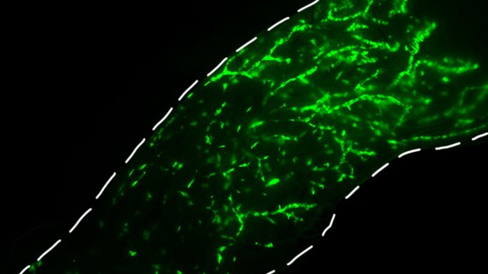 Fluorescence stereo micrograph of a mouse mammary gland intraductally injected with normal human breast epithelial cells © Marie Shamseddin / EPFL