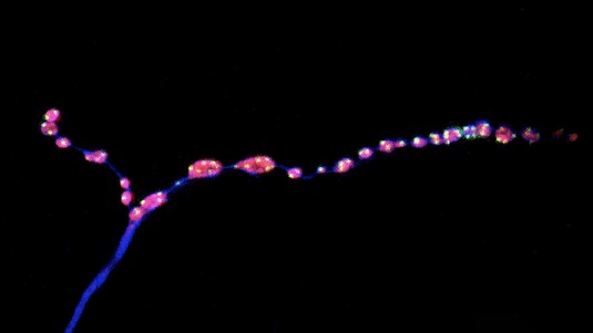 Adult Drosophila neuromuscular synaptic terminals. Motor neurons (blue), synaptic boutons (red) and neurotransmitter release sites (green). © Laboratory of Neural Genetics and Disease