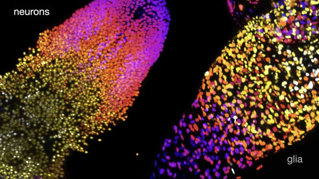 Neuronen und Gliazellen im ventralen Nervenstrang der Drosophila-Larve (analog zum Rückenmark). Credit: B. McCabe (EPFL)