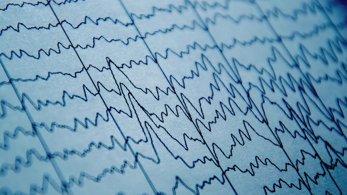 EPFL/ iStock EPFL/ iStock