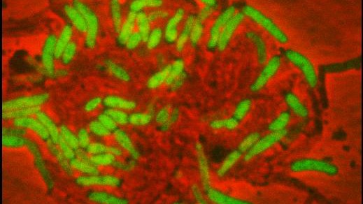 Bacterial ife, growth and death is now to be seen more accurately. © 2012 LMIC / EPFL