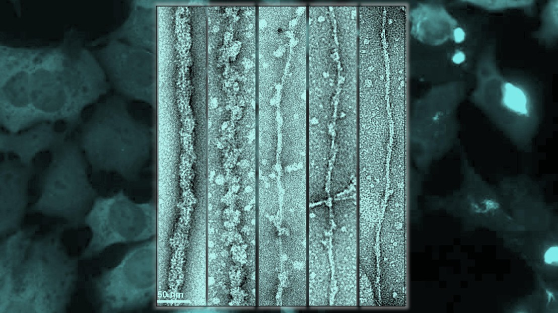 Illustration depicting how exposingTDP-43 fibril core enhances pathology formation in cell. 2023 EPFL / Galina Limorenko - CC-BY-SA 4.0 Illustration depicting how exposingTDP-43 fibril core enhances pathology formation in cell. 2023 EPFL / Galina Limorenko - CC-BY-SA 4.0