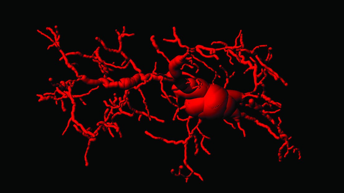 An activated microglia cell in the brain of cGAS/STING activated mice. © 2023 EPFL/ Gulen et al. Nature 02  August 2023. DOI: 10.1038/s41586-023-06373-1 (0)- CC-BY-SA 4.0