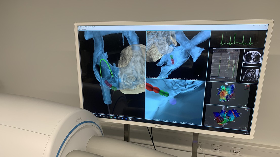 Cardiac intervention simulator. 2023 EPFL/ Unknown- CC-BY-SA 4.0