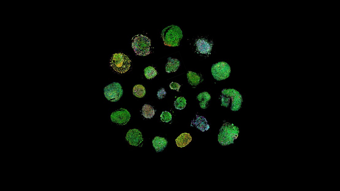 Lymphomoid spiral (created by Albert Santamaria-Martinez). Lymphomoid spiral (created by Albert Santamaria-Martinez).