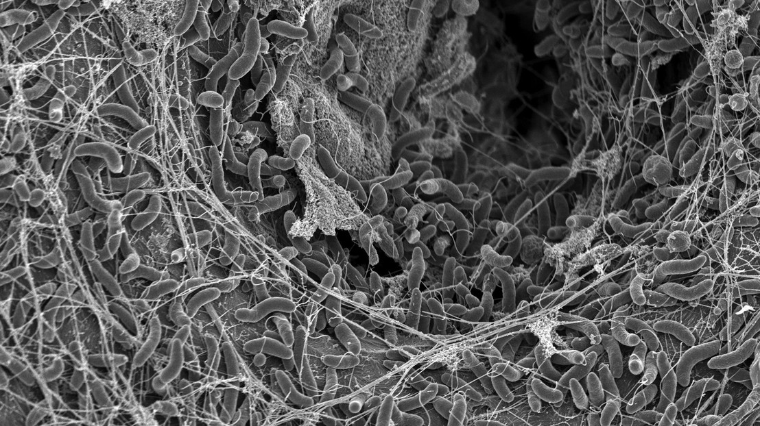 Vibrio cholerae bacteria, photo taken with a Scanning Electron Microscope. 2025 EPFL/Graham Knott et Melanie Blokesch - CC-BY-SA 4.0 Vibrio cholerae bacteria, photo taken with a Scanning Electron Microscope. 2025 EPFL/Graham Knott et Melanie Blokesch - CC-BY-SA 4.0
