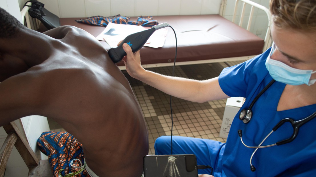 Dr. Véronique Suttels performs a smartphone-connected ultrasound on a symptomatic Beninese patient - 2025 EPFL/Véronique Suttels  - CC-BY-SA 4.0