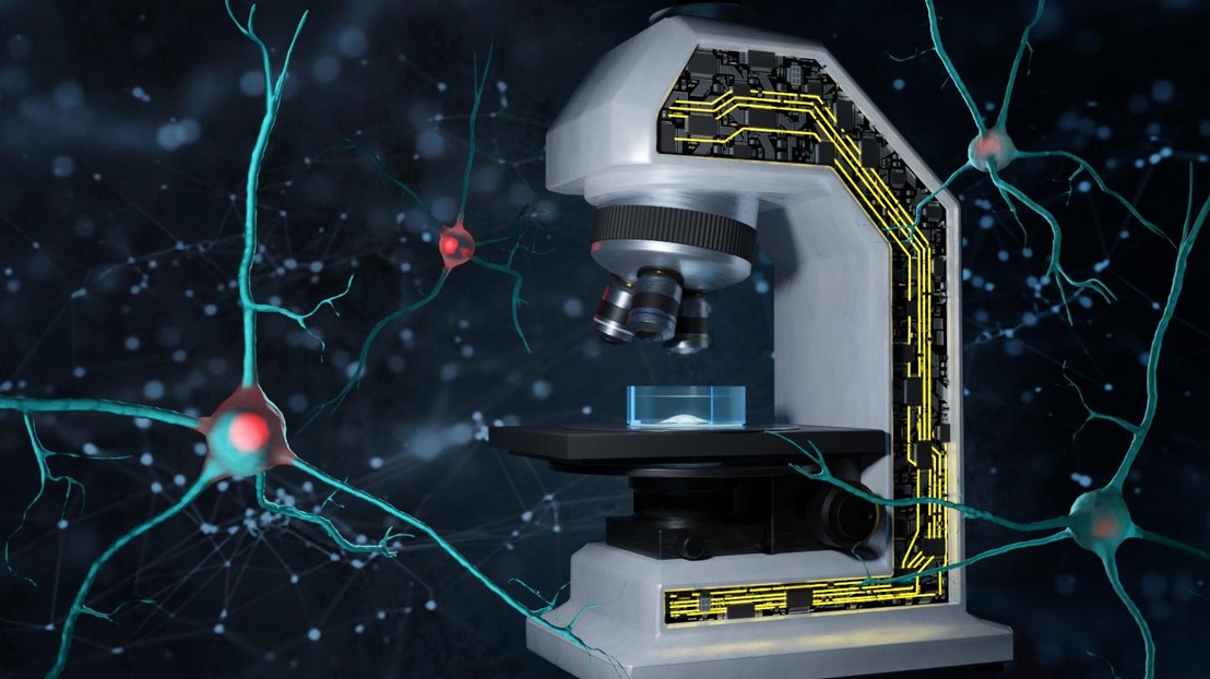 Thematic illustration of smart microscopy for detecting protein aggregation. 2025 Alexey Chizhik/EPFL - CC-BY-SA 4.0 Thematic illustration of smart microscopy for detecting protein aggregation. 2025 Alexey Chizhik/EPFL - CC-BY-SA 4.0