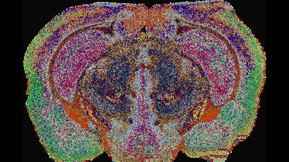 Lipizones in the mouse brain, determined by MALDI-MSI. Dots are enlarged for visualization purposes. Credit: 2026 EPFL/Luca Fusar Bassini - CC-BY-SA 4.0 Lipizones in the mouse brain, determined by MALDI-MSI. Dots are enlarged for visualization purposes. Credit: 2026 EPFL/Luca Fusar Bassini - CC-BY-SA 4.0