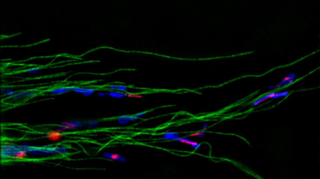 SiR-tubulin stained in green©Kai Johnsson/EPFL