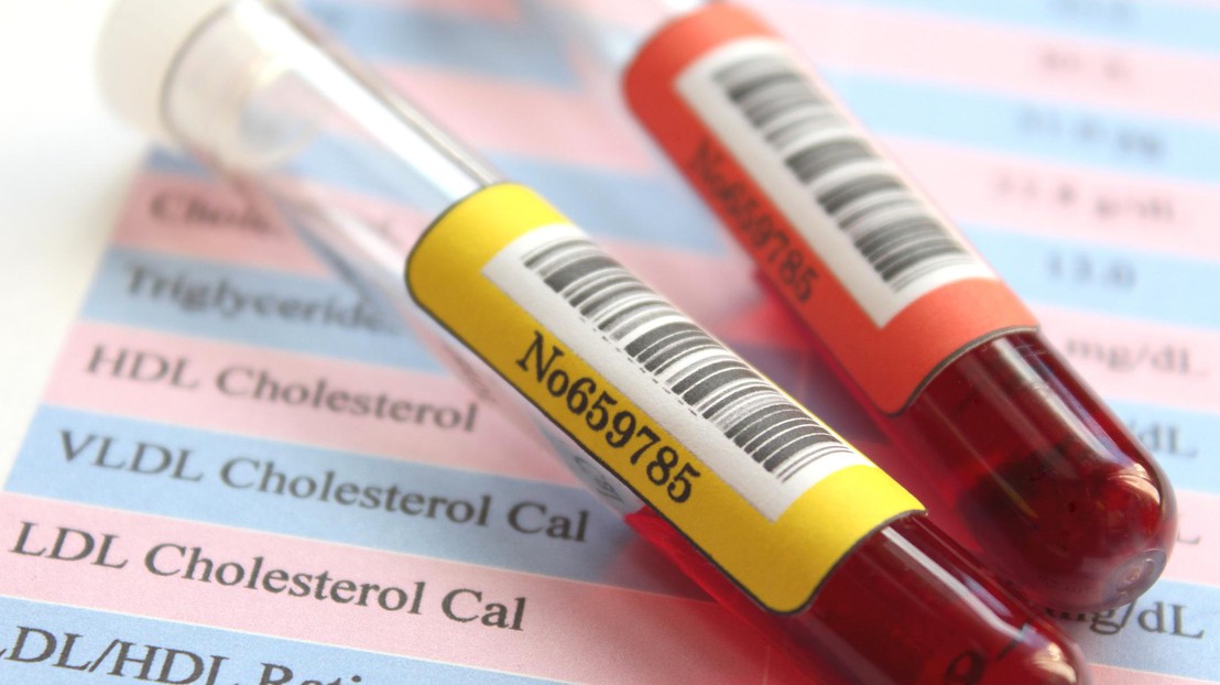 A breakthrough device developed by Loop Medical could indeed make it extremely simple to obtain blood samples. 2018 Ca-ssis A breakthrough device developed by Loop Medical could indeed make it extremely simple to obtain blood samples. 2018 Ca-ssis