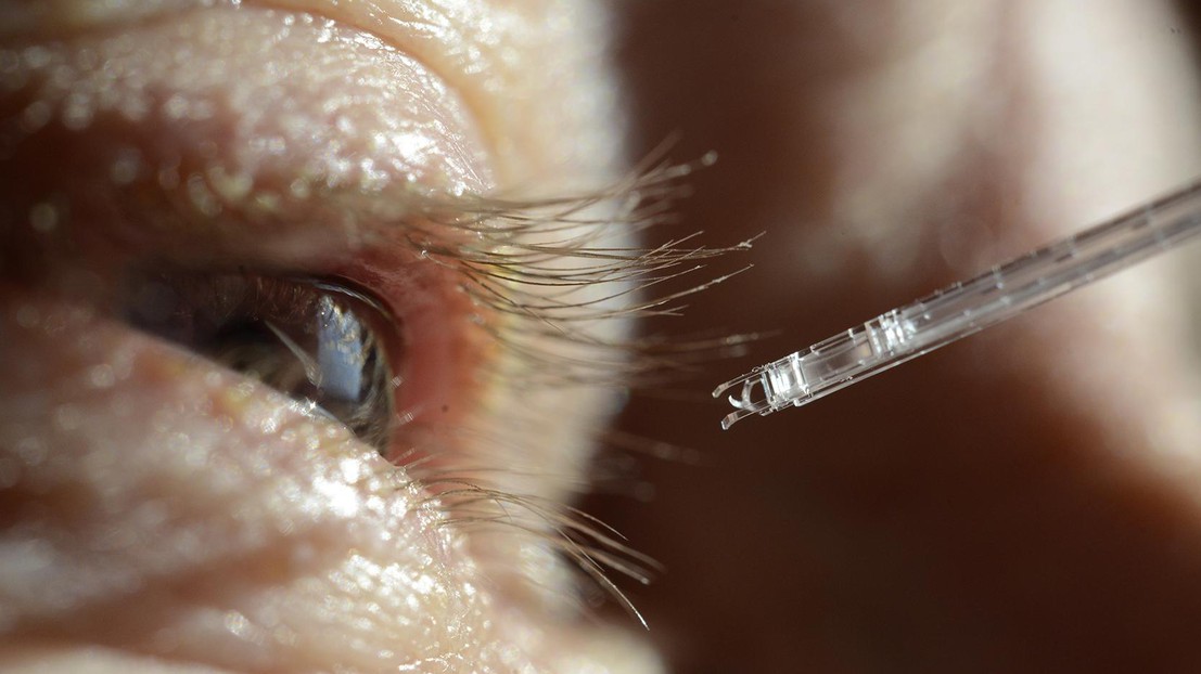 This new microscopic instrument provides the precision and stability needed to treat retinal venous occlusions. © Instant-Lab This new microscopic instrument provides the precision and stability needed to treat retinal venous occlusions. © Instant-Lab