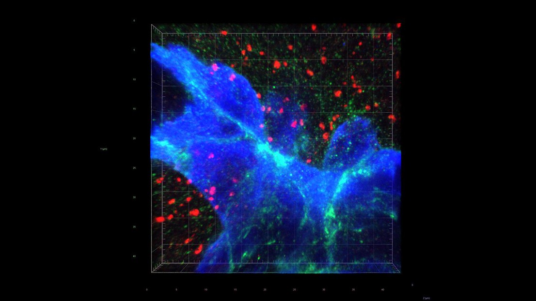 Synaptic proximity drives brain metastasis. Credit: W. Jiao and Q. Zeng (EPFL)