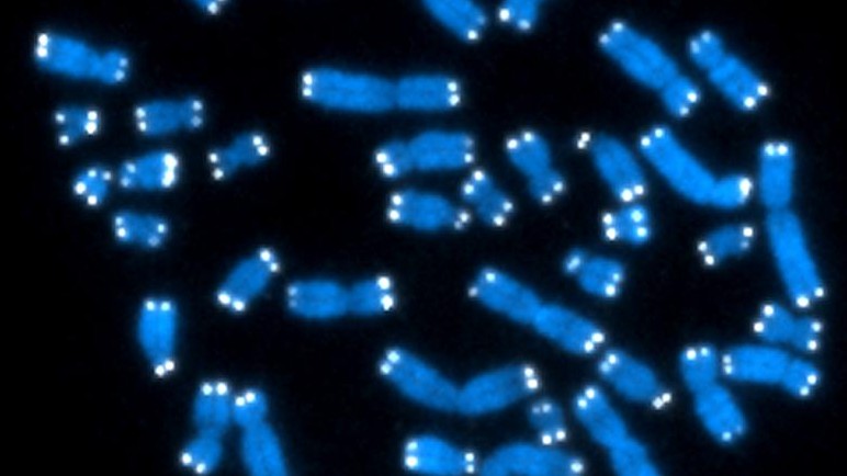 The telomeres can be seen as white dots on these chromosomes© National Institute of Health The telomeres can be seen as white dots on these chromosomes© National Institute of Health